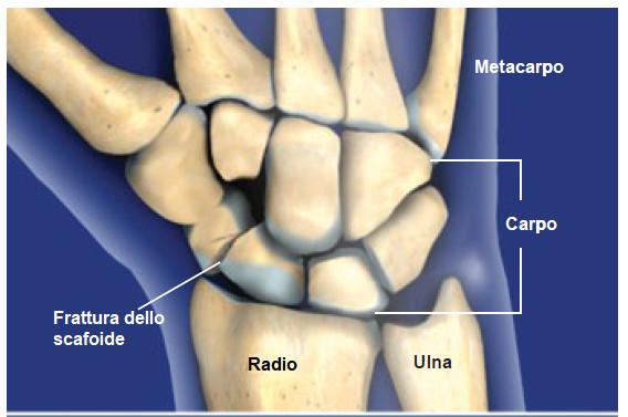 anatomia scafoide mano polso