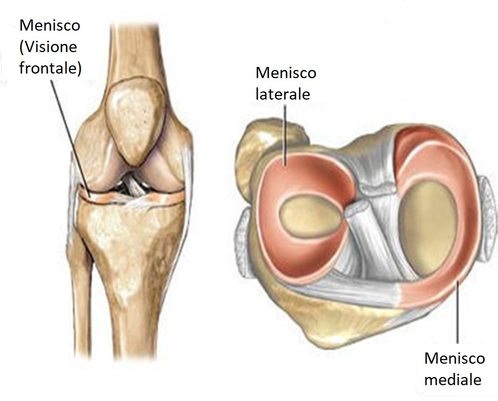menisco cura dolore lesione rottura ginocchio fisioterapia riabilitazione